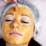 Why Is Inno Peel Popular for Skin Rejuvenation?