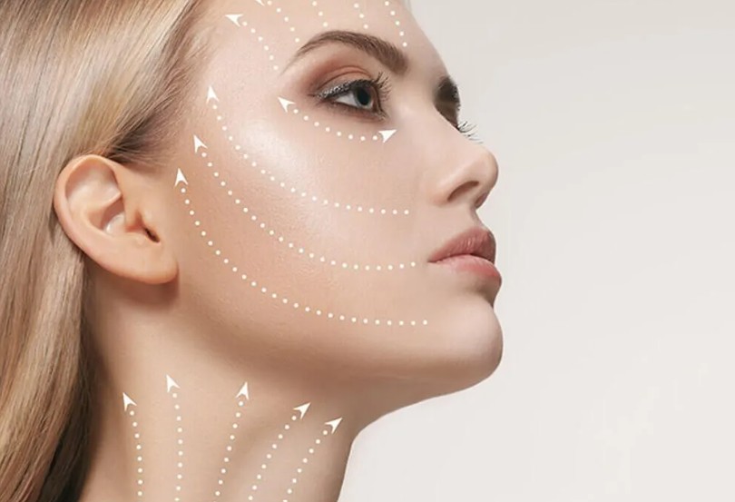 face lift