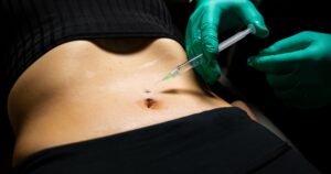 Top Features of a Trusted Body Fillers Clinic 1 Top Features of a Trusted Body Fillers Clinic