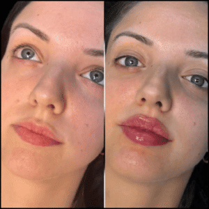 Why Choose the Best Plastic Surgeons in Dubai for Anti-Aging Fillers 1 Why Choose the Best Plastic Surgeons in Dubai for Anti-Aging Fillers
