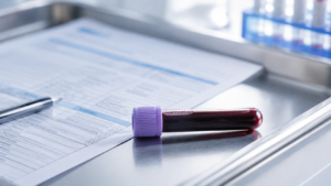 Signs You Need a Hormone Check: Symptoms to Watch For