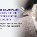 Why More People in Delhi Are Choosing Hair Transplant to Get Their Confidence Back 3 Why More People in Delhi Are Choosing Hair Transplant to Get Their Confidence Back