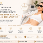 Laser hair removal in Gurgaon