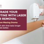 laser hair removal kara gmb