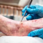 Family Foot Ankle Clinic