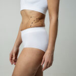 Unveil The Secret Of 360 Liposuction Surgery