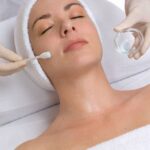 Can PCA Peel Treatment Help Fade Stubborn Acne Scars? 3 Can PCA Peel Treatment Help Fade Stubborn Acne Scars?