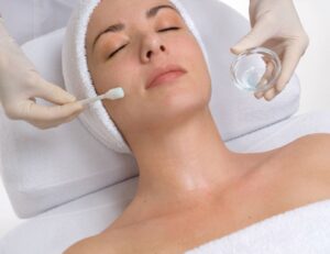 Can PCA Peel Treatment Help Fade Stubborn Acne Scars? 1 Can PCA Peel Treatment Help Fade Stubborn Acne Scars?