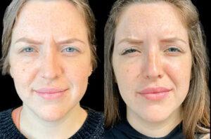 Is Botox Worth It? Insights from the Best Aesthetic Clinic in dubai 101 Is Botox Worth It? Insights from the Best Aesthetic Clinic in dubai