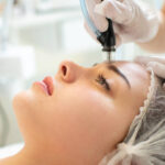 Hydrafacial in Riyadh 13