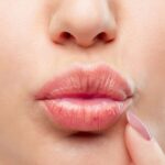 Lip Reduction in Dubai55