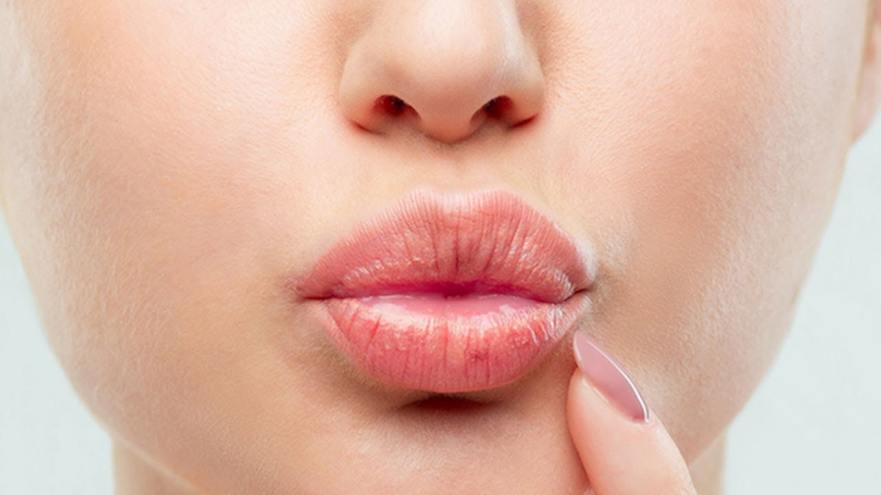 Lip Reduction in Dubai55