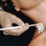 Ožiljci Od Akni: Koji Tretmani Zaista Mogu Poboljšati Izgled Kože? 3 Ožiljci Od Akni: Koji Tretmani Zaista Mogu Poboljšati Izgled Kože?
