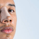 Rhinoplasty offer in Riyadh 19
