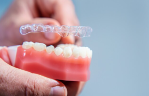 Trending Orthodontic Solutions for a Confident Smile