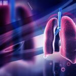 Sarcoidosis Symptoms: Early Warning Signs and Latest Treatment Options 3 Sarcoidosis Symptoms: Early Warning Signs and Latest Treatment Options