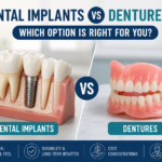 Dental Implants vs Dentures Which Option Is Right for You