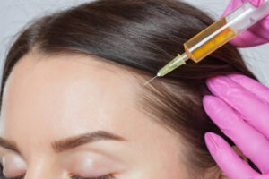 How Plasma-Based Treatments Support Scalp Health 1 How Plasma-Based Treatments Support Scalp Health