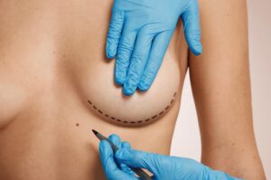 Breast Lift in Dubai: Safety Standards and Medical Regulations
