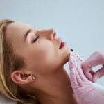 Russian Lip Fillers in Dubai 14