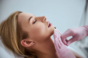 How Do Russian Lip Fillers in Dubai Lift the Lip Shape? 1 How Do Russian Lip Fillers in Dubai Lift the Lip Shape?