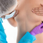 Comparing Silicone Breast Implant Shapes and Textures
