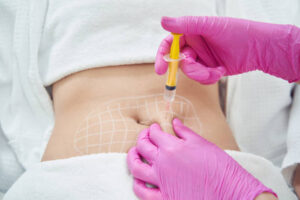 What Happens to Fat Cells After Fat Melting Injections? 1 What Happens to Fat Cells After Fat Melting Injections?
