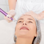 Potenza Microneedling in Riyadh 13