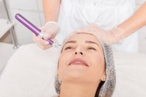 How Potenza Microneedling Differs From Traditional Microneedling