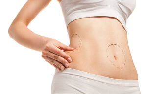 How Liposuction Can Enhance Your Natural Body Shape 1 How Liposuction Can Enhance Your Natural Body Shape