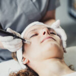 How Long Do DermaPen Results Typically Remain Visible? 4 How Long Do DermaPen Results Typically Remain Visible?