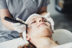 How Long Do DermaPen Results Typically Remain Visible? 1 How Long Do DermaPen Results Typically Remain Visible?