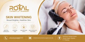 Skin Whitening in Islamabad: Is It Worth It? 1 Skin Whitening in Islamabad: Is It Worth It?