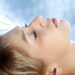 Acupuncture Treatment in Dubai 2