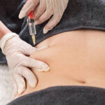 Fat dissolving injections in Riyadh 14