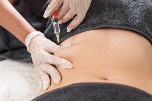 Fat Dissolving Injections: Separating Facts From Common Myths 1 Fat Dissolving Injections: Separating Facts From Common Myths