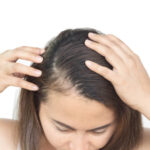 When Can You Expect Results From PRP Hair Treatment? 3 When Can You Expect Results From PRP Hair Treatment?