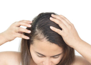 When Can You Expect Results From PRP Hair Treatment? 1 When Can You Expect Results From PRP Hair Treatment?