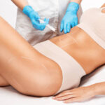 Fat Melting Injections for Women: Targeted Areas That Respond Well