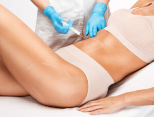 Fat Melting Injections for Women: Targeted Areas That Respond Well