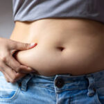 Tummy Tuck Surgery for Post-Weight Loss Patients: What to Know 3 Tummy Tuck Surgery for Post-Weight Loss Patients: What to Know