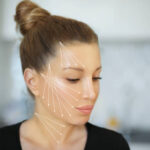 Silhouette Threads or PDO: Which Gives a Stronger Facial Lift?