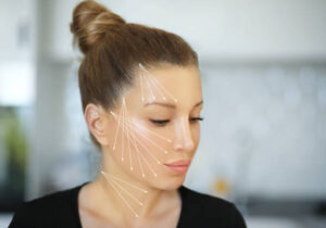 Silhouette Threads or PDO: Which Gives a Stronger Facial Lift? 1 Silhouette Threads or PDO: Which Gives a Stronger Facial Lift?