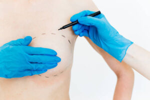 Silicone Breast Implants: Impact on Mammograms and Imaging 1 Silicone Breast Implants: Impact on Mammograms and Imaging