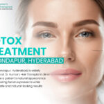 Botox treatment