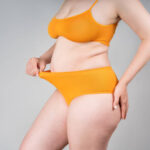 What Determines the Right Tummy Tuck Technique for Each Patient?