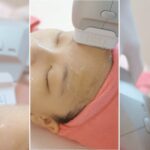 Nodule Pimple Treatment Putrajaya 2