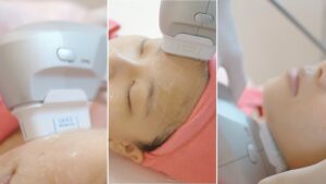 Best Pimple Treatment Johor Bahru