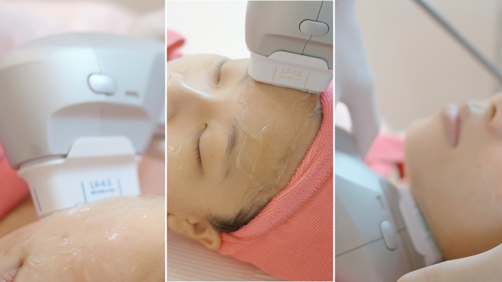 Nodule Pimple Treatment Putrajaya 2