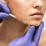 Jawline Filler Injections in Dubai 11